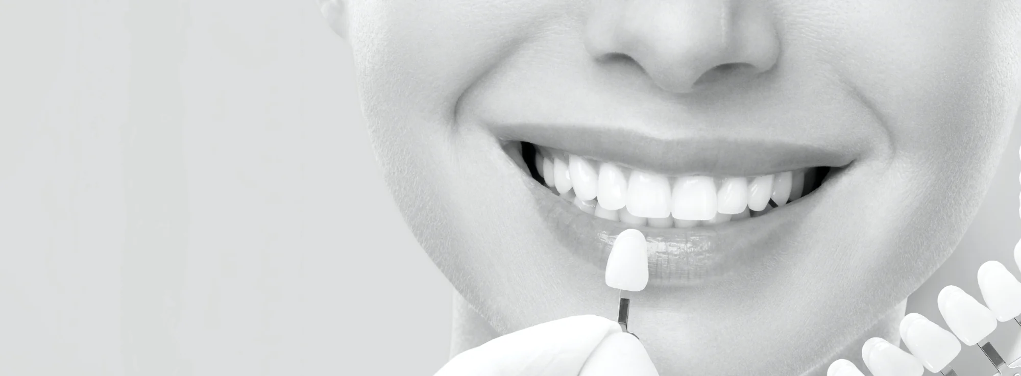 Luxurious dental experience with SK Align clear braces and dental implants