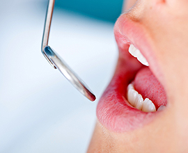 Dental Examinations