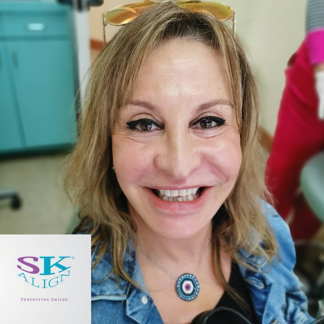 SK Align Case 5 - Before & After